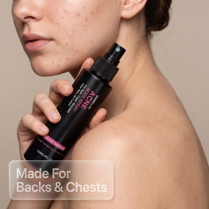 Skinwell Acne Spray