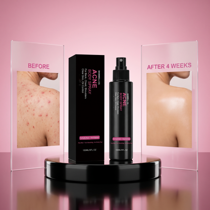 Skinwell Acne Spray